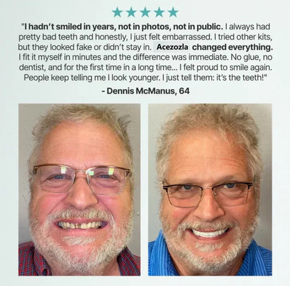 🎅New Year HOT SALE-🏆Ends Today: 70% OFF! 🦷 Acezozla™ Custom-Fit Fully Functional Dentures for a More Confident Smile!